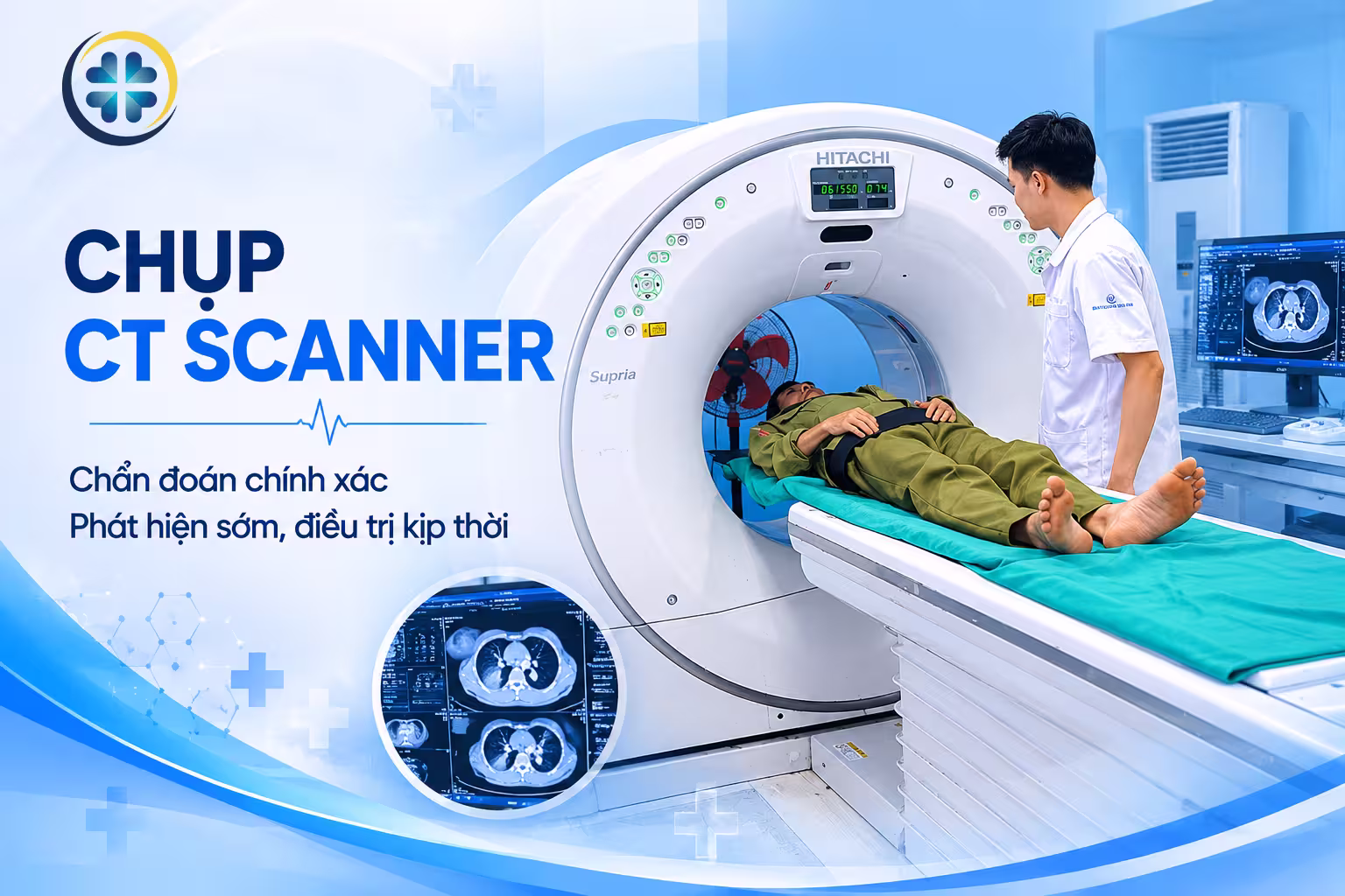 Chụp CT Scanner
